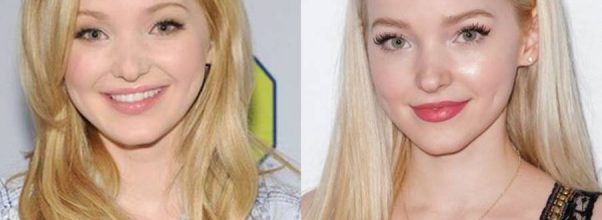 Dove Cameron Before Plastic Surgery